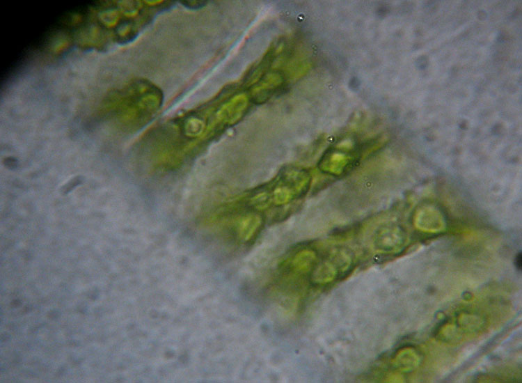 Alghe 3: Spirogyra sp